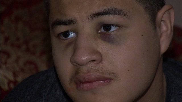 David Gonzalez, had two black eyes beginning to show, on top of the blood.